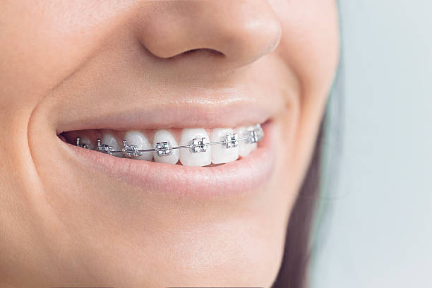 Why Choose Us for Your Dental Needs in Beacon Square, FL